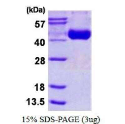 SDS-Page: Recombinant Influenza A Virus H3N2 Influenza A H3N2 Hemagglutinin (A/canine/Guangdong/1/2006) His Protein [NBP1-99037] - SDS-Page: Recombinant Virus Influenza A H3N2 Hemagglutinin Protein [NBP1-99037]