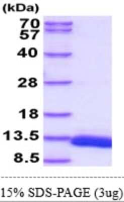 SDS-Page: Recombinant Mouse ACBP Isoform 2 Protein [NBP2-61996] - 15% SDS-PAGE (3ug)