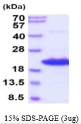 SDS-Page: Recombinant Mouse AG-2 Protein [NBP2-59537] - 15% SDS-PAGE (3ug)