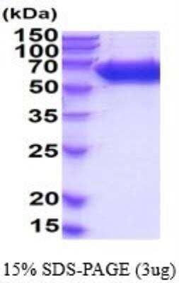 SDS-Page: Recombinant Mouse Alkaline Phosphatase, Tissue Non-Specific Protein [NBP2-53066] - 15% SDS-PAGE (3ug)