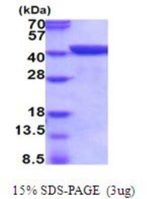 SDS-Page: Recombinant Mouse Annexin A1 Protein [NBP2-52001]