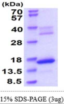 SDS-Page: Recombinant Mouse Bax Protein [NBP2-61456] - 15% SDS-Page (3ug)