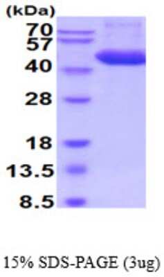 SDS-Page: Recombinant Mouse Cathepsin D Protein [NBP2-59524] - 15% SDS-PAGE (3ug)