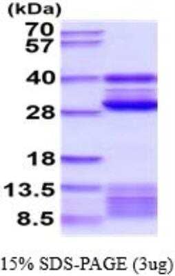 SDS-PAGE Recombinant Mouse Cathepsin S His Protein