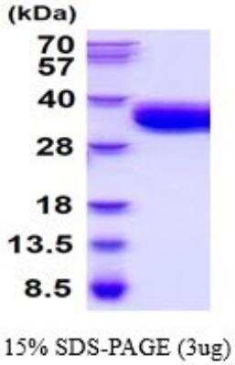 SDS-Page: Recombinant Mouse Coagulation Factor III/Tissue Factor Protein [NBP2-52327]