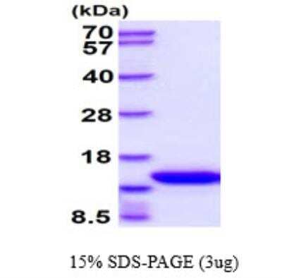 SDS-Page: Recombinant Mouse Common beta Chain Protein [NBC1-18483] - 3ug by SDS-PAGE under reducing condition and visualized by coomassie blue stain. Molecular Weight: 14 kDa (125 aa), confirmed by MALDI-TOF.Concentration: 1 mg/ml (determined by BCA assay).