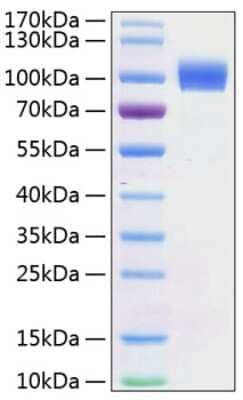 SDS-Page: Recombinant Mouse ErbB2/Her2 His (C-Term) Protein [NBP3-18206] - Recombinant Mouse ErbB2/Her2 Protein was determined by SDS-PAGE with Coomassie Blue, showing a band at 100-110 kDa.