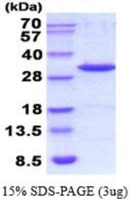 SDS-Page: Recombinant Mouse Galectin-3 Protein [NBP2-52248]
