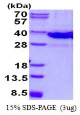 SDS-Page: Recombinant Mouse Galectin-8 Protein [NBP2-23186]