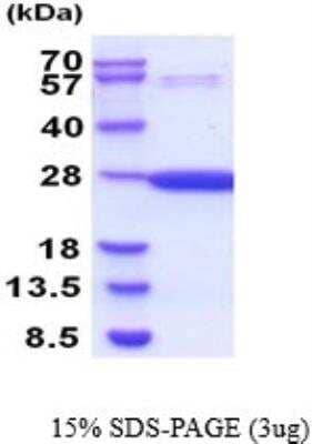 SDS-Page: Recombinant Mouse Glutathione S-Transferase pi 1/GSTP1 Protein [NBP2-52149]