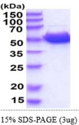 SDS-Page: Recombinant Mouse Guanine deaminase Protein [NBP2-60220] - 15 % SDS-PAGE (3ug)