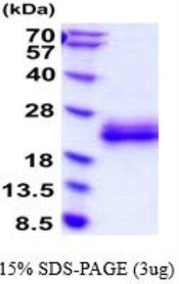 SDS-Page: Recombinant Mouse IL-3 Protein [NBP2-52211] - 15% SDS Page (3 ug)