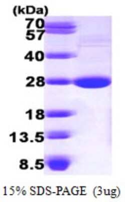 SDS-Page: Recombinant Mouse LYPLA1 Protein [NBP1-48592] - 15 % SDS-PAGE (3ug)