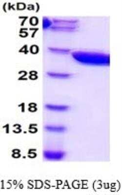 SDS-Page: Recombinant Mouse Lactate Dehydrogenase A/LDHA Protein [NBP2-52341]