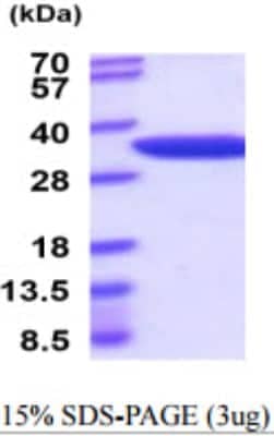 SDS-Page: Recombinant Mouse NMNAT-1 Protein [NBP2-59928] - 15% SDS-PAGE