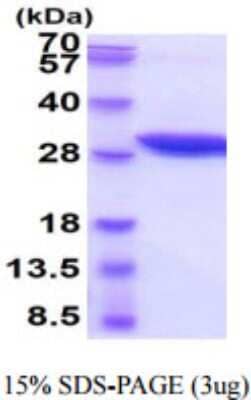 SDS-PAGE Recombinant Mouse Nicotinamide N-Methyltransferase/NNMT His Protein