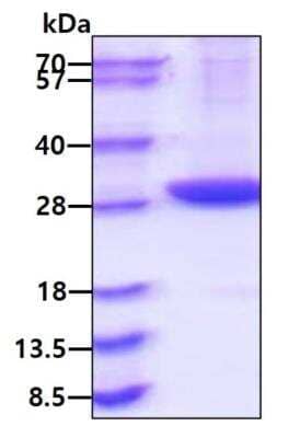 SDS-PAGE Recombinant Mouse Pentraxin 2/SAP His Protein