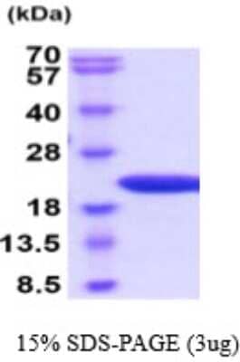 SDS-Page: Recombinant Mouse Pin1 Protein [NBP2-59587] - 15% SDS-PAGE (3ug)