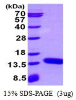 SDS-Page: Recombinant Mouse S100A3 Protein [NBP2-23449]