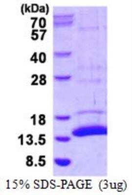 SDS-Page: Recombinant Mouse S100A7A Protein [NBP2-23450]