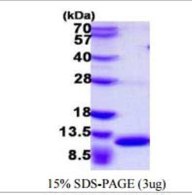 SDS-Page: Recombinant Mouse S100A8 Protein [NBP1-72331]