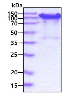 SDS-Page: Recombinant Mouse SPARC-like 1/SPARCL1 His Protein [NBP2-77490] - 3ug by SDS-PAGE under reducing condition and visualized by coomassie blue stain.