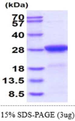 SDS-PAGE Recombinant Mouse Adenylate Kinase 1 His Protein