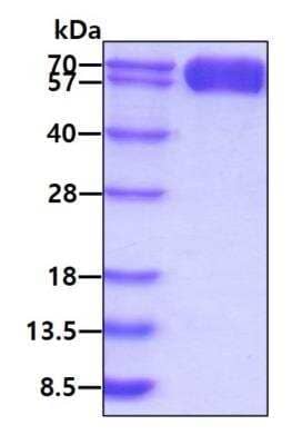 SDS-Page: Recombinant Mouse TIM-3 hIgG-His Protein [NBP3-07123] - 3ug by SDS-PAGE under reducing condition and visualized by coomassie blue stain.