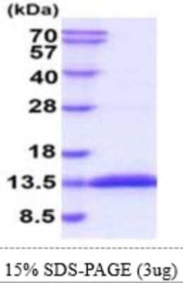 SDS-Page: Recombinant Mouse TRAIL R4/TNFRSF10D/DcR2 Protein [NBP2-61198] - 15 % SDS-PAGE (3ug)