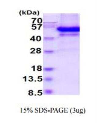 SDS-PAGE Recombinant Mouse Testican 3/SPOCK3 His Protein