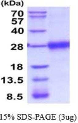 SDS-Page: Recombinant Mouse VISTA/B7-H5/PD-1H Protein [NBP2-52229] - 15% SDS Page (3 ug)