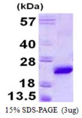 SDS-Page: Recombinant Mouse VPS29 Protein [NBP1-99056] - 15% SDS-PAGE (3ug)