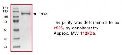 SDS-Page: Recombinant RSK3 Protein [NBP1-99503]