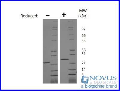 SDS-Page: Recombinant Rat Prolactin Animal-Free Protein [NBP2-76199] - 1 ug in each lane (-) non-reducing conditions and (+) reducing conditions in a 4-20% Tris-Glycine gel.