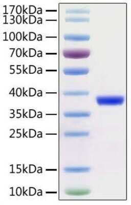 SDS-Page: Recombinant SARS-CoV-2 3CL Protease (Avi Epitope Tag) His Avi-tag Protein [NBP2-92992] - Recombinant Virus SARS-CoV-2 3CL Protease Avi Epitope Tag Protein [NBP2-92992] - Recombinant Virus SARS-CoV-2 3CL Protease with His and Avi tag was determined by SDS-PAGE with Coomassie Blue, showing a band at 38 kDa.