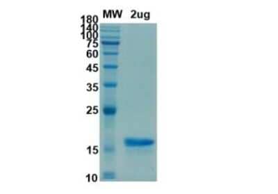 SDS-Page: Recombinant SARS-CoV-2 Membrane Protein His (N-Term) Protein [NBP3-07080] - SDS-PAGE Image