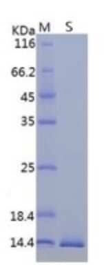 SDS-PAGE Recombinant SARS-CoV-2 ORF8 His Protein