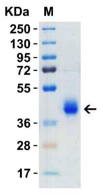SDS-Page: Recombinant SARS-CoV-2 Spike (RBD+SD1) His (C-Term) Protein [NBP3-07950] - SDS-PAGE Validation with Spike Recombinant Protein. Loading: 1 ug Spike recombinant protein, NBP3-07950. Observed: 40kD