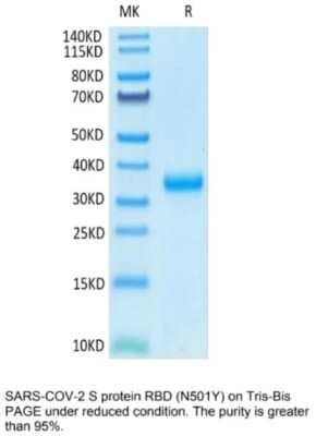 SDS-Page: Recombinant SARS-CoV-2 Spike RBD (N501Y) Protein [NBP3-07930] - Recombinant SARS-CoV-2 Spike RBD (N501Y) Protein on Tris-Bis PAGE under reduced condition. The purity is great than 95%.