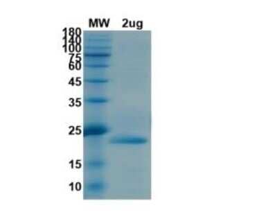 SDS-Page: Recombinant SARS-CoV-2 nsp1 His (N-Term) Protein [NBP3-07952] - SDS-PAGE Image