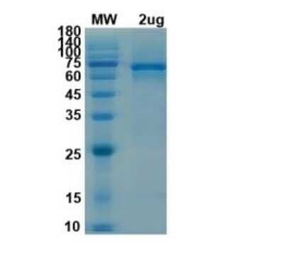 SDS-PAGE Recombinant SARS-CoV-2 nsp13 His (N-Term) Protein