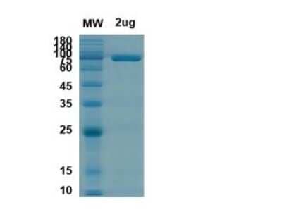SDS-PAGE Recombinant SARS-CoV-2 nsp2 His (N-Term) Protein