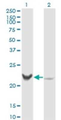 Western Blot: Recoverin Antibody (3G10) [H00005957-M02] - Analysis of RCVRN expression in transfected 293T cell line by RCV1 monoclonal antibody (M02), clone 3G10.Lane 1: RCVRN transfected lysate(23.1 KDa).Lane 2: Non-transfected lysate.