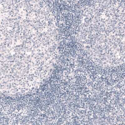 Immunohistochemistry-Paraffin: Reelin Antibody (CL5324) [NBP2-61414] - Staining of human tonsil shows no positivity in lymphoid cells as expected (negative control).