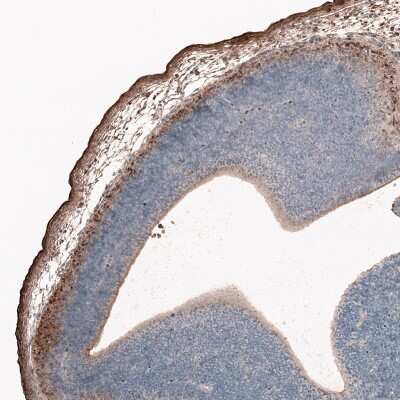 Immunohistochemistry-Paraffin: Reelin Antibody (CL5324) [NBP2-61414] - Staining of mouse embryo E11 shows strong positivity in cells in the outer layer of developing cortical plate.