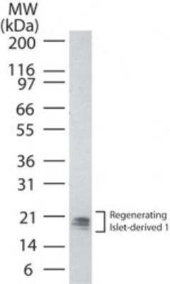 Western Blot: Reg1B Antibody [NBP2-24778] - analysis of human pancreas lysate using Reg1 antibody at 0.5 ug/ml. Multiple isoforms of the protein can be seen. I goat anti-rabbit Ig HRP secondary antibody and PicoTect ECL substrate solution were used for this test.