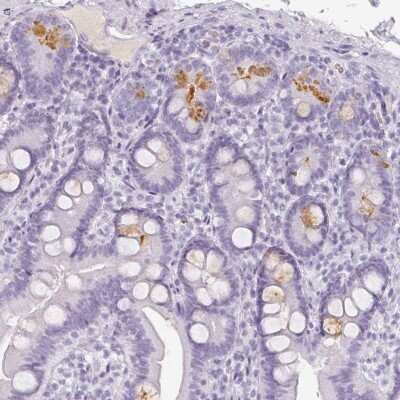 Immunohistochemistry-Paraffin: Reg3A Antibody [NBP2-56947] - Immunohistochemical staining of human duodenum shows moderate cytoplasmic positivity in subset of glandular cells.