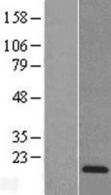 Western Blot: Reg3a Overexpression Lysate (Adult Normal) [NBL1-15274] Left-Empty vector transfected control cell lysate (HEK293 cell lysate); Right -Over-expression Lysate for Reg3a.