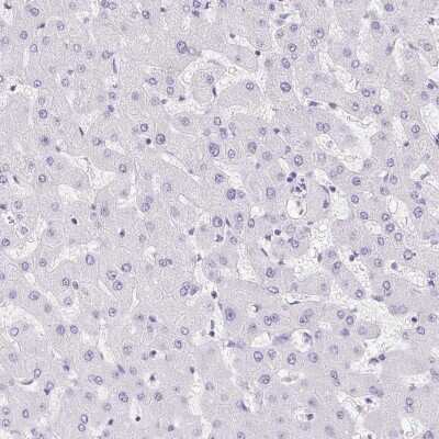 Immunohistochemistry-Paraffin: Reg4 Antibody [NBP2-38552] - Staining of human liver shows no positivity as expected.