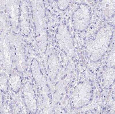 Immunohistochemistry-Paraffin: Reg4 Antibody [NBP2-38552] - Staining of human stomach shows no positivity in a subset of glandular cells. 